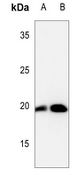 Cofilin (pS3) Antibody