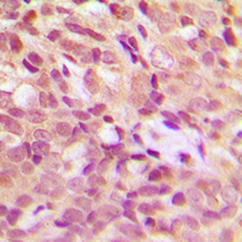 HSP27 (pS15) Antibody