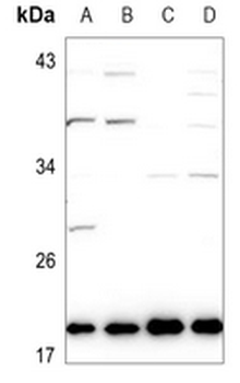 Ephrin A1 Antibody