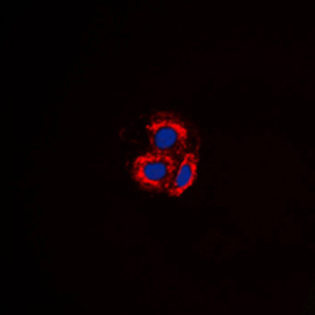 ALK1 Antibody