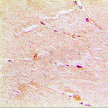Gamma-actin-1 Antibody