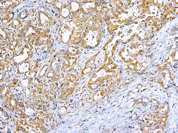 TNF-ALPHA Antibody