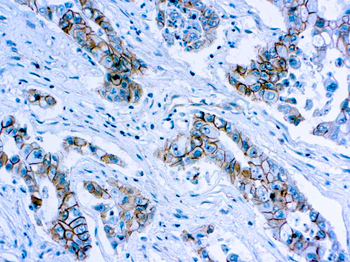 BETA-CATENIN Antibody