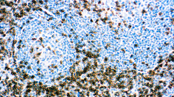 CD3 Antibody