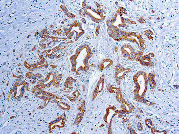 VASCULAR ENDOTHELIAL GROWTH FACTOR(VEGF) Antibody