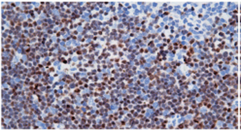 PD-L1 Antibody