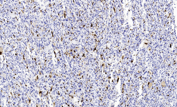 Myogenin Antibody