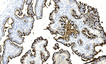 Mesothelin Antibody