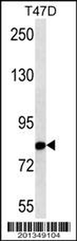 THOC1 Antibody (N-term)