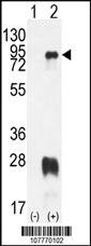 PRMT7 Antibody (N-term)