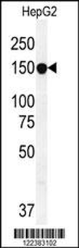 ABCC10 Antibody (Center)