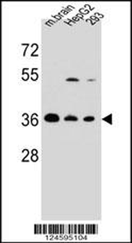 FBXO2 Antibody (C-term)