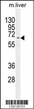 KY Antibody (N-term)