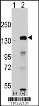 JHDM1a/FBXL11 Antibody (Center)