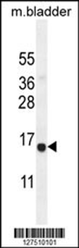 CHIC2 Antibody (C-term)