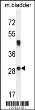 NCALD Antibody (C-term)