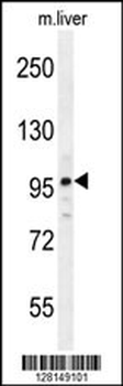 NARG2 Antibody (N-term)