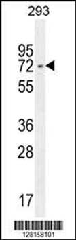 I2BP2 Antibody (Center)