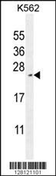 RTP4 Antibody (C-term)