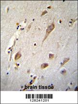NXNL2 Antibody (Center)