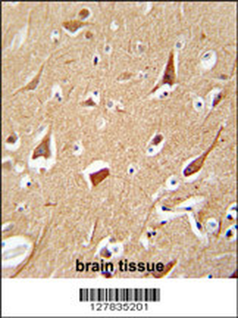 ZFYVE28 Antibody (C-term)