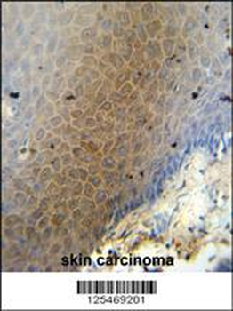 CEP70 Antibody (Center)