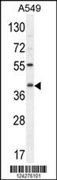 C5AR1 Antibody (Center)