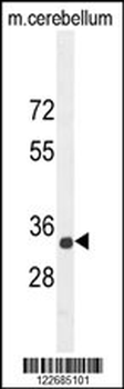 CADM1 Antibody (N-term)