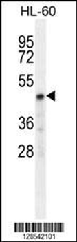 CHST2 Antibody (Center)