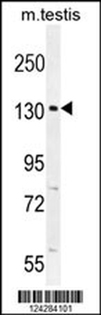 CIC Antibody (N-term)