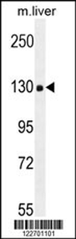 COL18A1 Antibody (Center)