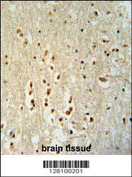 PTOV1 Antibody (N-term)