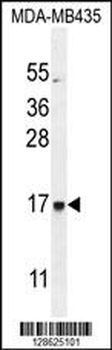 CU002 Antibody (C-term)