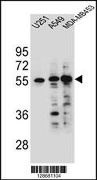 SYNCI Antibody (N-term)