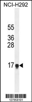 HEPN1 Antibody (N-term)