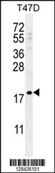 LCE1A Antibody (C-term)