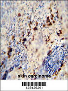 LCE1A Antibody (C-term)