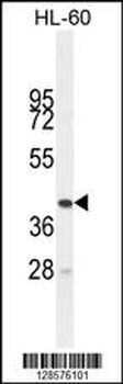 BTNL3 Antibody (C-term)