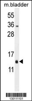 RM51 Antibody (C-term)
