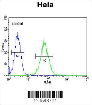 SMYD1 Antibody (C-term)