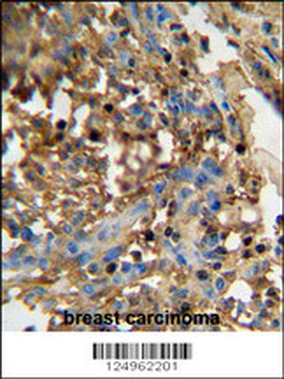 DMP4 Antibody (C-term)