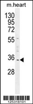 UPP2 Antibody (C-term)