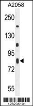 ERMARD Antibody (Center)
