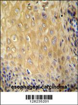 ERMARD Antibody (Center)
