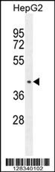 CCDC17 Antibody (C-term)