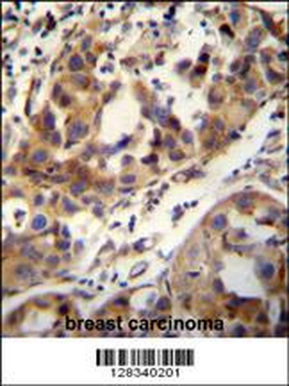 CCDC17 Antibody (C-term)
