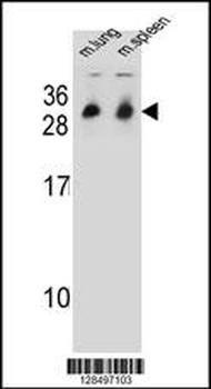 CYB561D1 Antibody (C-term)