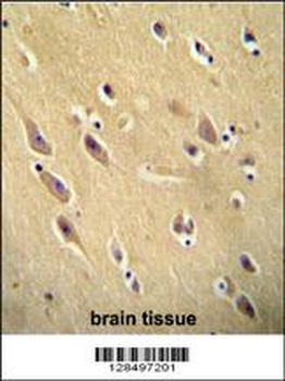 CYB561D1 Antibody (C-term)