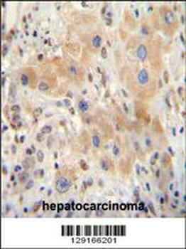 NR0B2 Antibody (Center)