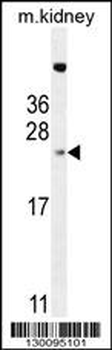 ADO Antibody (C-term)